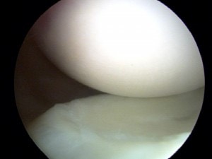Smooth Knee Cartilage